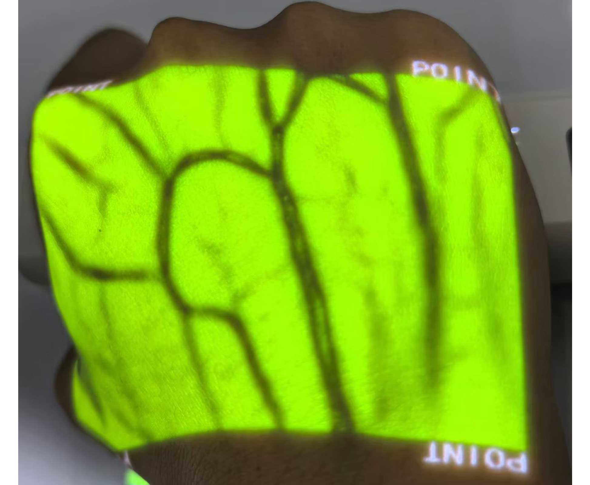 HF-410A Vein Finder - Image 5