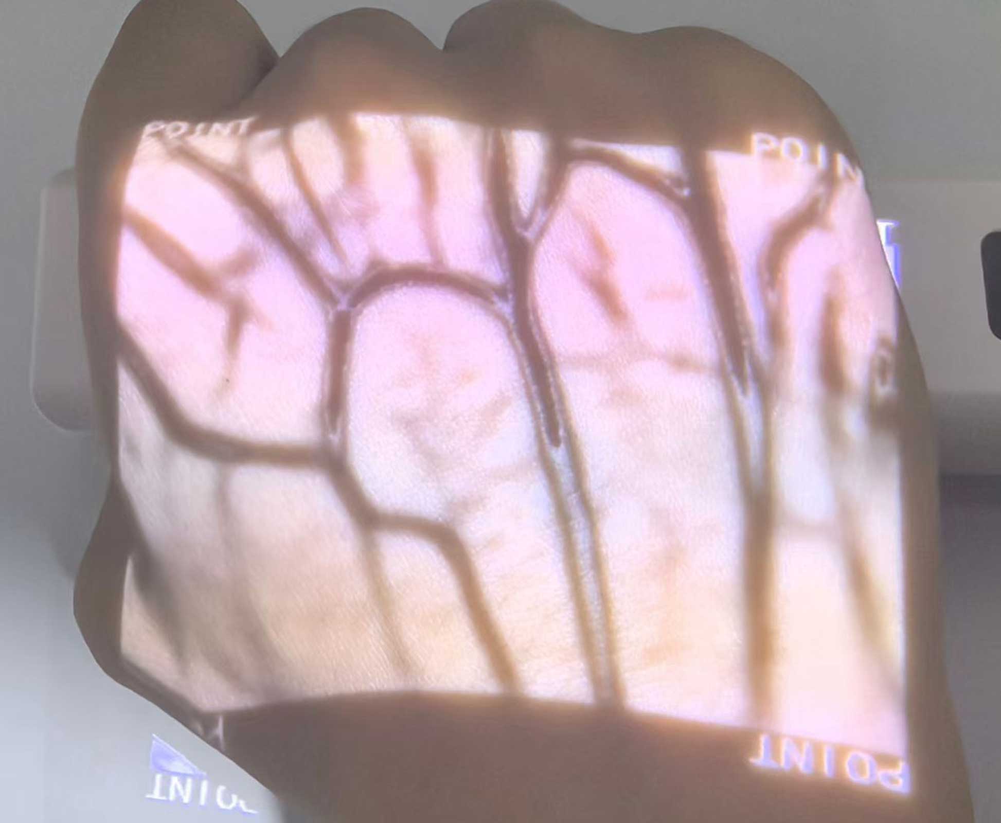 HF-410A Vein Finder - Image 7