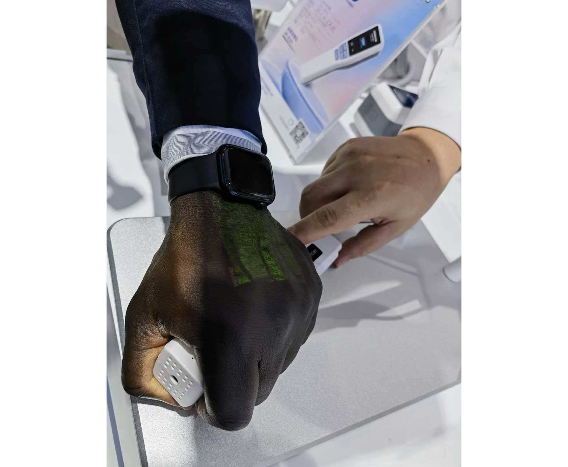 HF-410A Vein Finder - Image 2