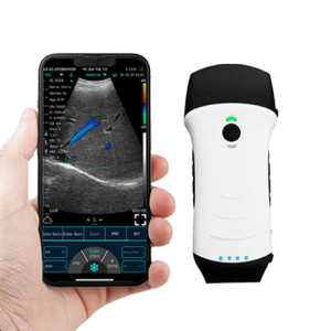 C10TX 3-in-1 Pocket Ultrasound