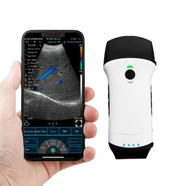 USG-removebg-preview